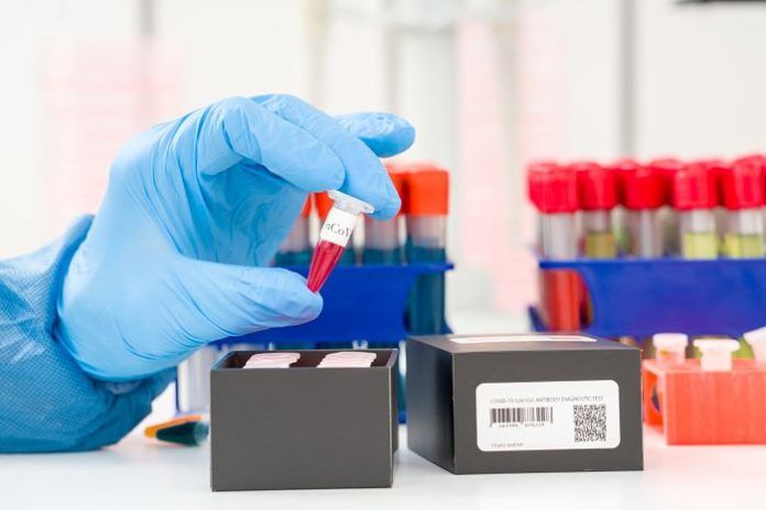 PCR